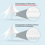 Varianten Sternpavillon: alternativ mit Einfassband oder mit Reißverschluss
