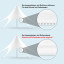 Varianten Sternpavillon: alternativ mit Reißverschluss oder mit Einfassband